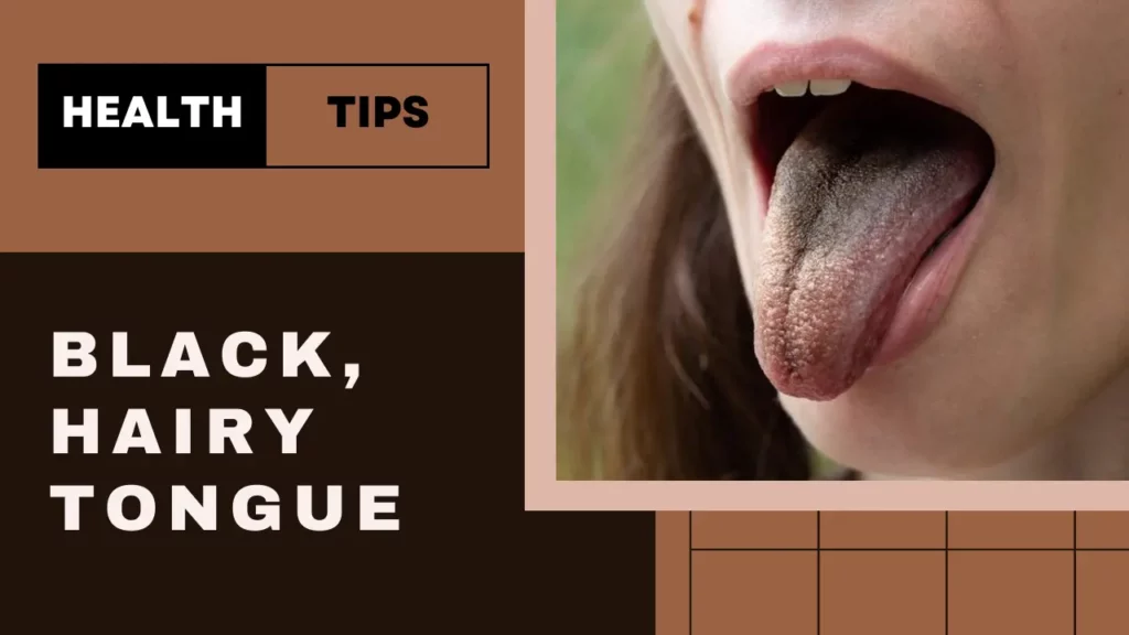 Tongue Health Chart