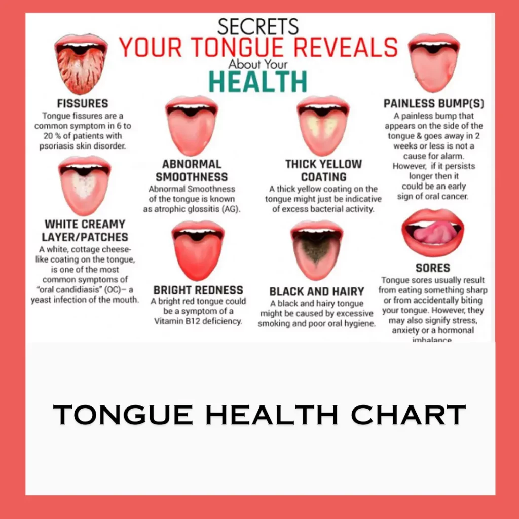 Tongue Health Chart