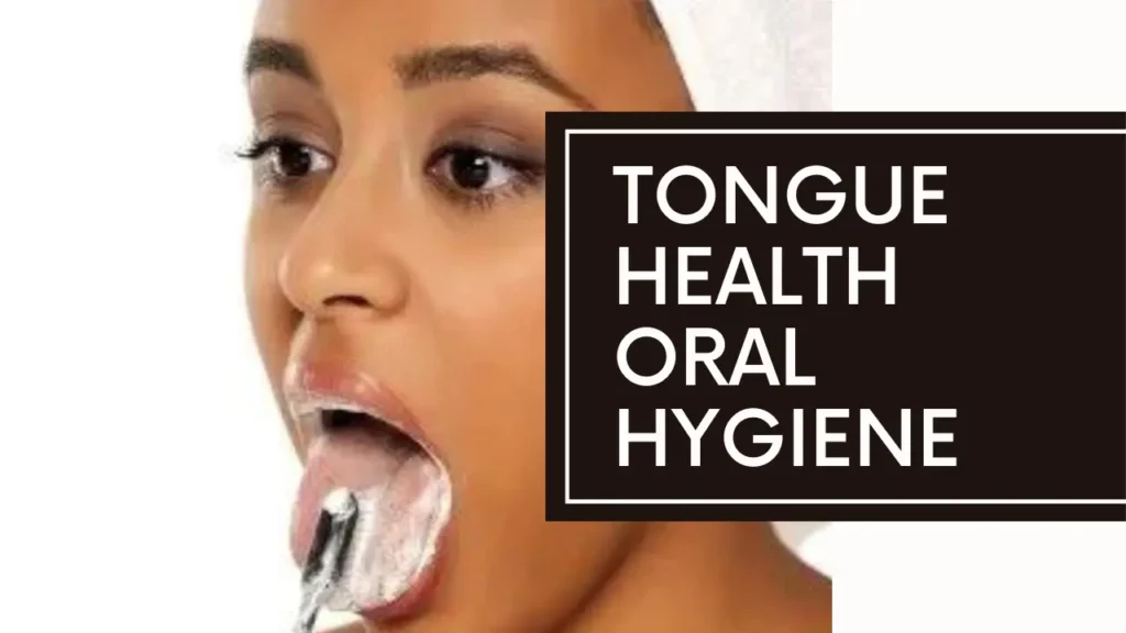 Tongue Health Chart