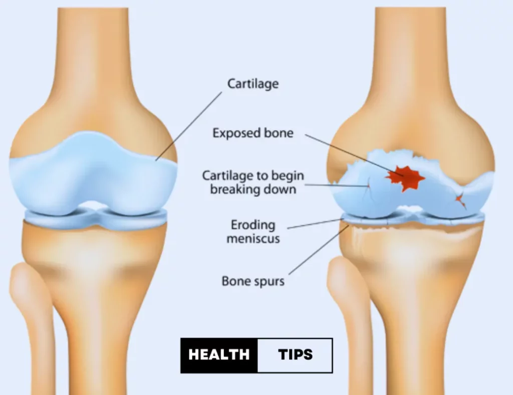 Knee Feels Tight Assessment