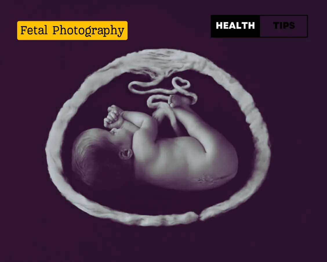 Fetal Photography